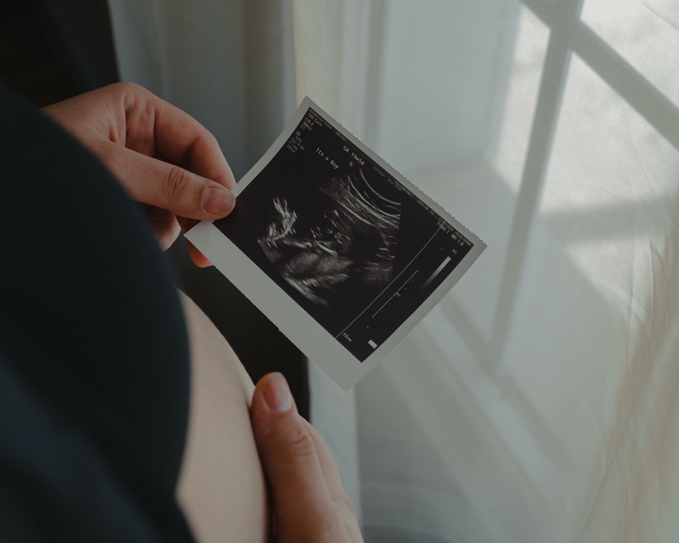 Abortion, Personhood, and the Beginning of Life